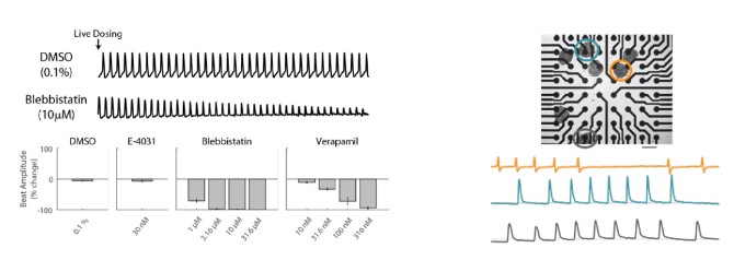 Contractility