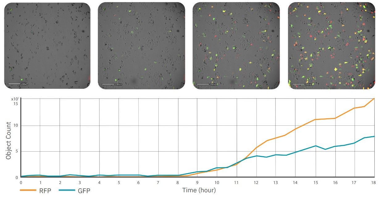 AI analysis