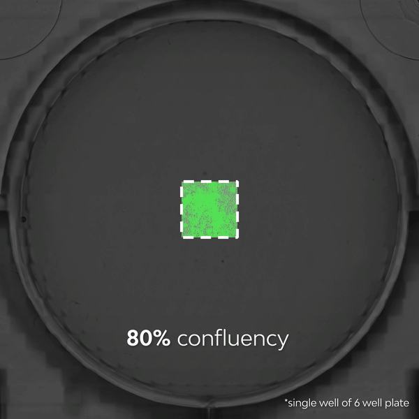 Fluorescent cell timelapse