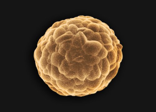 In vitro Cancer Spheroid Assay